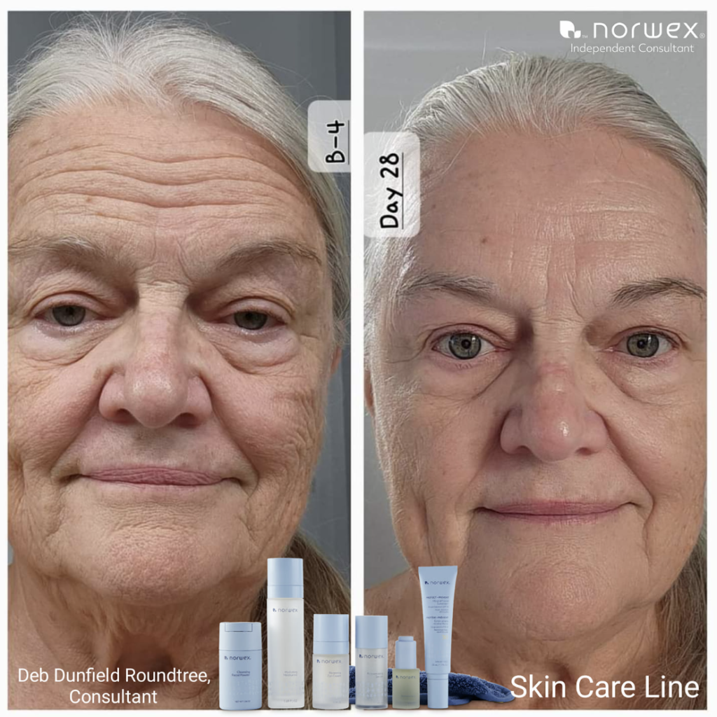 Norwex Skincare Before and After Photo Deb Dunfield Roundtree